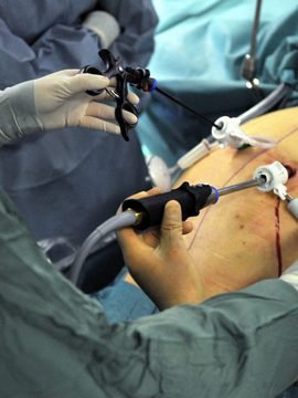 Magenbypass-Operation